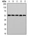 NK2 Homeobox 1 antibody, orb388721, Biorbyt, Western Blot image 