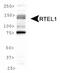 Regulator Of Telomere Elongation Helicase 1 antibody, TA336935, Origene, Western Blot image 