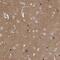 Protein Phosphatase 1 Regulatory Subunit 9A antibody, HPA027726, Atlas Antibodies, Immunohistochemistry paraffin image 