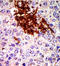 RIO Kinase 1 antibody, AP13875PU-N, Origene, Immunohistochemistry paraffin image 