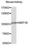 Meprin A subunit beta antibody, STJ112125, St John