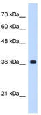 Chromosome 19 Open Reading Frame 47 antibody, TA346665, Origene, Western Blot image 