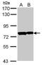 POZ/BTB And AT Hook Containing Zinc Finger 1 antibody, GTX115725, GeneTex, Western Blot image 