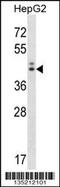 Neuroguidin antibody, 58-075, ProSci, Western Blot image 