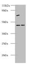 Eukaryotic Translation Initiation Factor 4A2 antibody, A53857-100, Epigentek, Western Blot image 