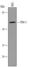Tryptophan Hydroxylase 1 antibody, AF5276, R&D Systems, Western Blot image 