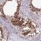 Nodal homolog antibody, HPA045201, Atlas Antibodies, Immunohistochemistry frozen image 