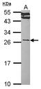 RAS Like Proto-Oncogene A antibody, LS-C186352, Lifespan Biosciences, Western Blot image 