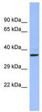 CHRNA7 (Exons 5-10) And FAM7A (Exons A-E) Fusion antibody, TA341659, Origene, Western Blot image 