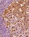 KI-67 antibody, NB500-170, Novus Biologicals, Immunohistochemistry paraffin image 