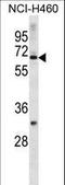 Zinc Finger Protein 185 With LIM Domain antibody, LS-C157051, Lifespan Biosciences, Western Blot image 
