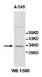 Zinc Finger Protein 146 antibody, orb77957, Biorbyt, Western Blot image 