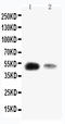 Kruppel Like Factor 8 antibody, LS-C313028, Lifespan Biosciences, Western Blot image 