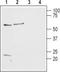 Histamine H2 receptor antibody, TA328864, Origene, Western Blot image 