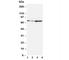 Proprotein Convertase Subtilisin/Kexin Type 9 antibody, R31245, NSJ Bioreagents, Western Blot image 