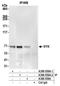 Spleen Associated Tyrosine Kinase antibody, A300-559A, Bethyl Labs, Immunoprecipitation image 