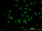 Nuclear nucleic acid-binding protein C1D antibody, LS-C133645, Lifespan Biosciences, Immunofluorescence image 