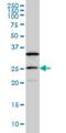 Dephospho-CoA Kinase Domain Containing antibody, H00079877-M02, Novus Biologicals, Western Blot image 