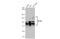 Nuclear autoantigen Sp-100 antibody, GTX131569, GeneTex, Western Blot image 