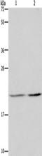 Anti-Silencing Function 1A Histone Chaperone antibody, TA349664, Origene, Western Blot image 