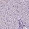ATRX Chromatin Remodeler antibody, NBP2-52938, Novus Biologicals, Immunohistochemistry paraffin image 