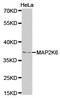 Dual specificity mitogen-activated protein kinase kinase 6 antibody, TA327385, Origene, Western Blot image 