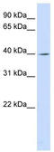 Leucine Rich Repeat Containing 28 antibody, TA340335, Origene, Western Blot image 