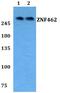 Zinc Finger Protein 462 antibody, PA5-75821, Invitrogen Antibodies, Western Blot image 