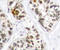 RELB Proto-Oncogene, NF-KB Subunit antibody, STJ22383, St John