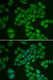 3-Hydroxy-3-Methylglutaryl-CoA Reductase antibody, LS-C748368, Lifespan Biosciences, Immunofluorescence image 