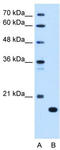 Complement component C8 beta chain antibody, TA334646, Origene, Western Blot image 