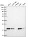 MLC-2 antibody, HPA045244, Atlas Antibodies, Western Blot image 