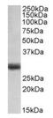 Fibroblast Growth Factor 5 antibody, orb125229, Biorbyt, Western Blot image 