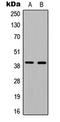 Ataxin-7-like protein 3 antibody, LS-C354279, Lifespan Biosciences, Western Blot image 