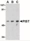 Golgi Associated PDZ And Coiled-Coil Motif Containing antibody, NBP1-77243, Novus Biologicals, Western Blot image 