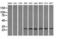 Replication Protein A2 antibody, GTX83691, GeneTex, Western Blot image 