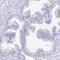 Paternally Expressed 10 antibody, PA5-62299, Invitrogen Antibodies, Immunohistochemistry paraffin image 