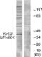 Potassium Voltage-Gated Channel Subfamily J Member 11 antibody, PA5-40157, Invitrogen Antibodies, Western Blot image 