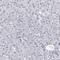 MYOC antibody, NBP1-89769, Novus Biologicals, Immunohistochemistry paraffin image 