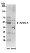 Aurora A antibody, A300-071A, Bethyl Labs, Western Blot image 