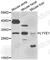 Lymphatic Vessel Endothelial Hyaluronan Receptor 1 antibody, A6452, ABclonal Technology, Western Blot image 