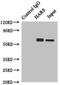 Histidyl-TRNA Synthetase antibody, LS-C375873, Lifespan Biosciences, Immunoprecipitation image 