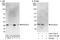 Exosome Component 4 antibody, A303-774A, Bethyl Labs, Western Blot image 