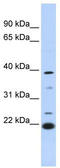 Penta-EF-Hand Domain Containing 1 antibody, TA344308, Origene, Western Blot image 