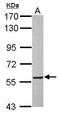 DnaJ Heat Shock Protein Family (Hsp40) Member C3 antibody, GTX111367, GeneTex, Western Blot image 