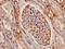 ATP Synthase F1 Subunit Gamma antibody, LS-C669743, Lifespan Biosciences, Immunohistochemistry paraffin image 