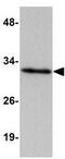 HAD antibody, GTX85015, GeneTex, Western Blot image 