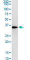 Ribosomal Protein Lateral Stalk Subunit P0 antibody, LS-C198115, Lifespan Biosciences, Western Blot image 