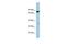 Serine Dehydratase antibody, A02273, Boster Biological Technology, Western Blot image 