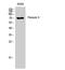 Peroxisomal targeting signal 1 receptor antibody, A02406-1, Boster Biological Technology, Western Blot image 